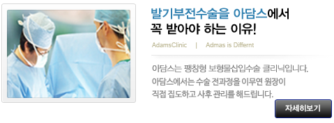 발기부전수술을 아담스에서 꼭 받아야 하는 이유!