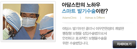 아담스만의노하우. 스마트발기수술이란?