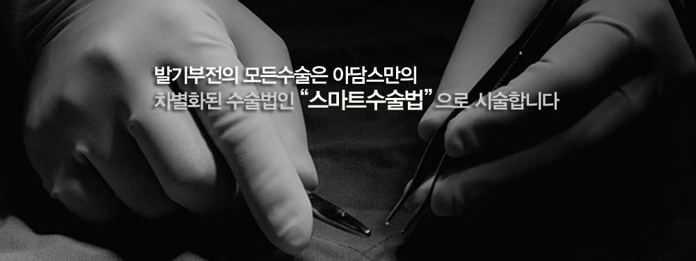 발기부전의 모든 수술은 아담스만의 차별화된 수술법인 스마트수술법으로 시술합니다